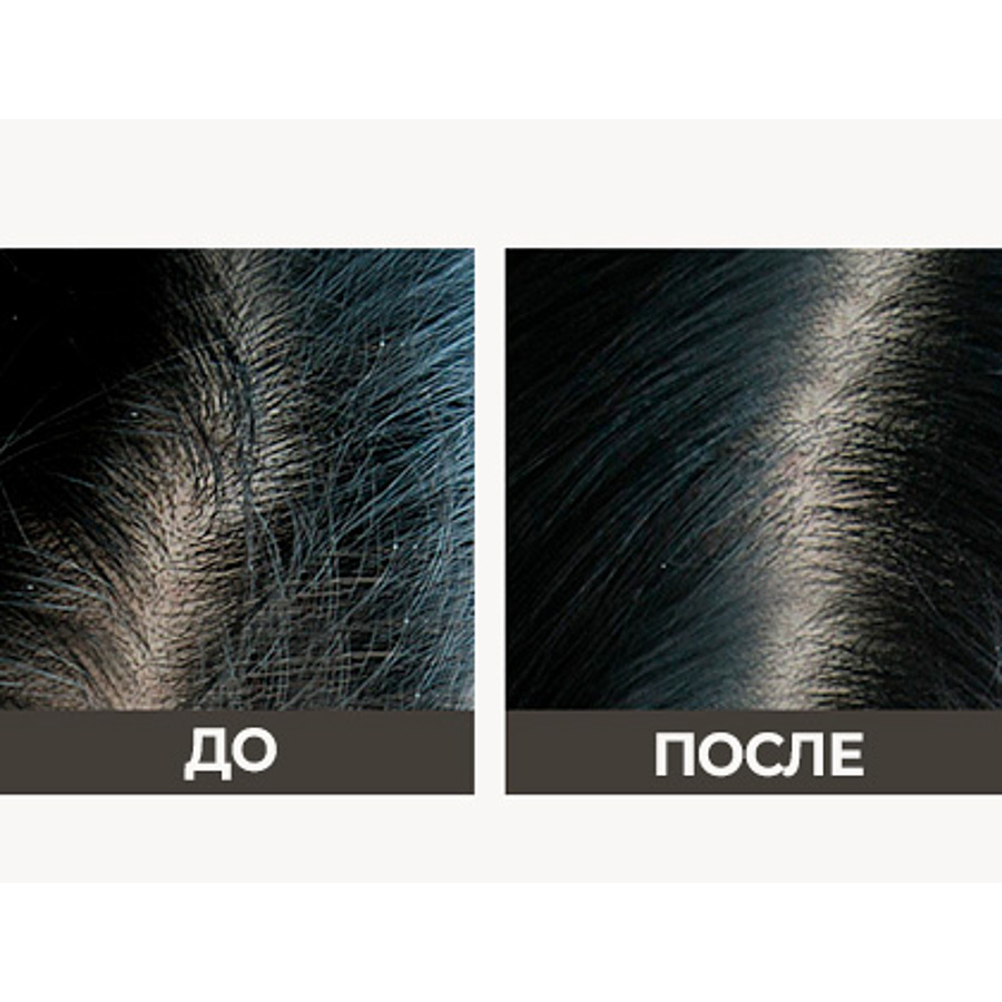 LA'DOR Professional Salon Hair Care Triplex Natural Shampoo, 150мл. Шампунь для чувствительной кожи головы