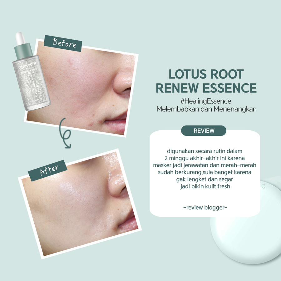 TheYEON Lotus Root Renew Essence, 50мл. TheYEON Эссенция для лица восстанавливающая с экстрактом лотоса