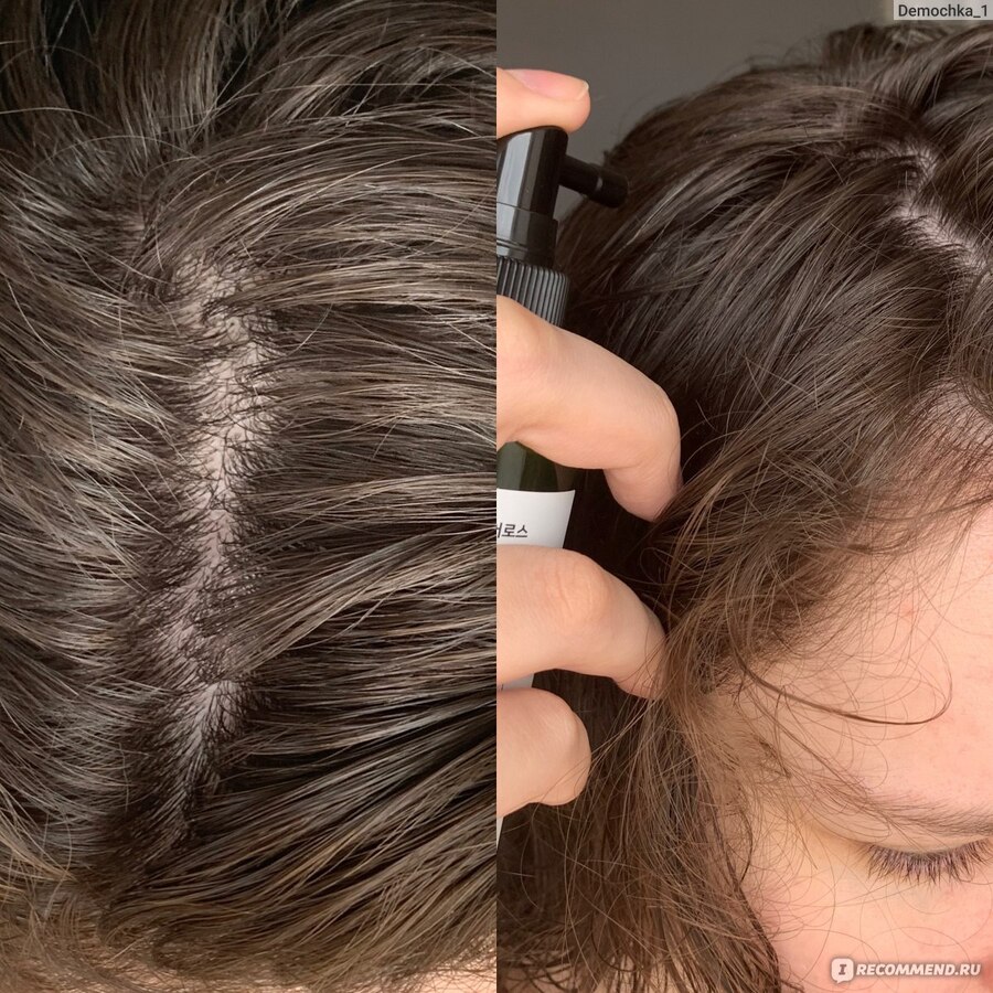 SOME BY MI Cica Peptide Anti Hair Loss Tonic, 150мл. Тоник против выпадения волос с центеллой азиатской и пептидами